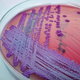 Imagen para el artículo titulado Bacterias tropicales mortales encontradas en suelo continental de EE. UU. por primera vez